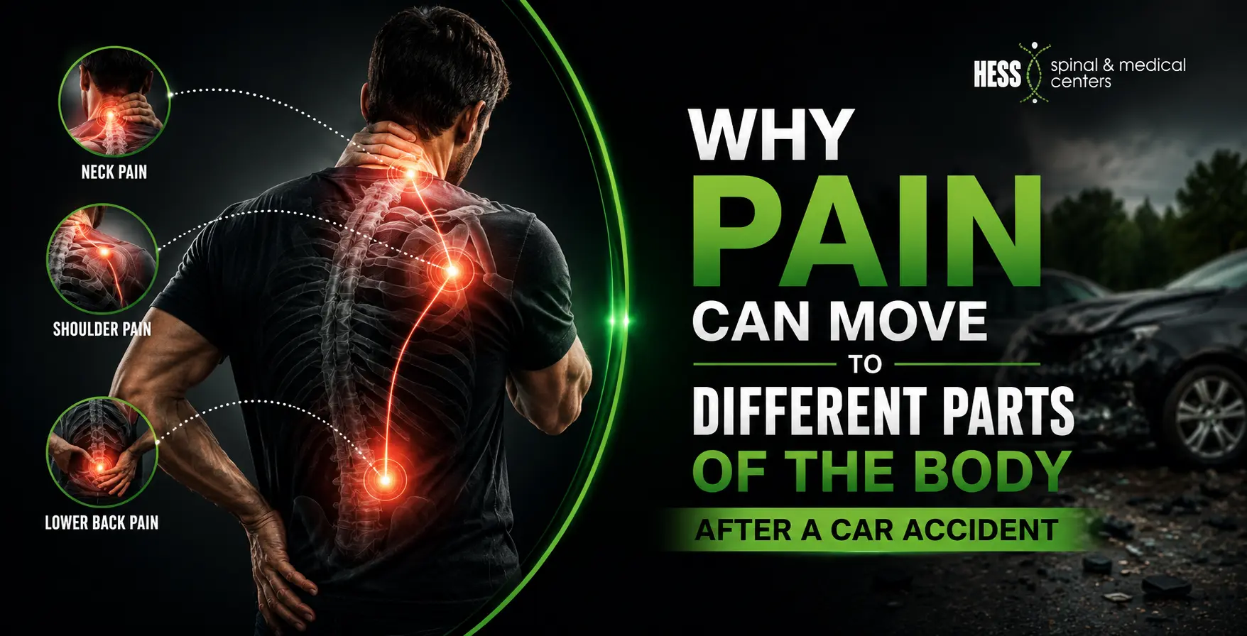 Illustration showing neck, shoulder, and lower back pain spreading after a car accident and causing symptoms elsewhere.
